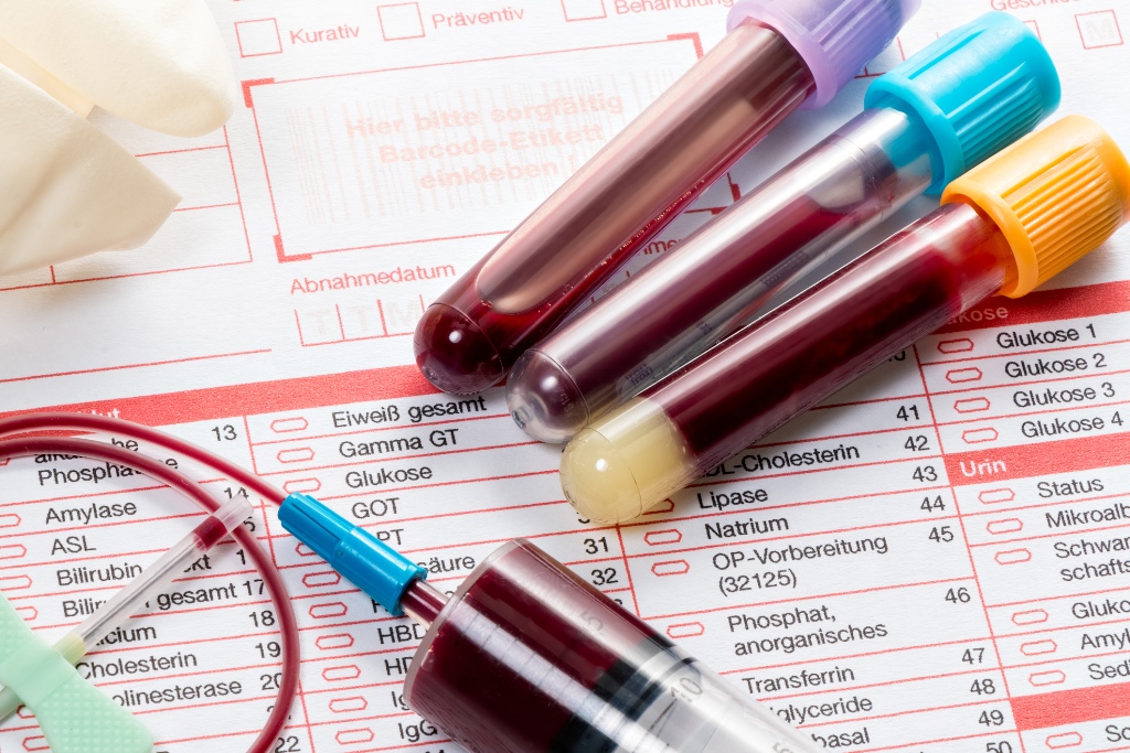 Схемы оплаты лечения гепатита С по ОМС предложено дифференцировать .